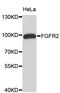 Fibroblast Growth Factor Receptor 2 antibody, STJ110894, St John
