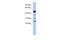 Hematopoietic Prostaglandin D Synthase antibody, PA5-43217, Invitrogen Antibodies, Western Blot image 