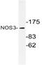 Nitric Oxide Synthase 3 antibody, AP20681PU-N, Origene, Western Blot image 