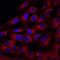 STRO1 antibody, MAB1038, R&D Systems, Immunofluorescence image 