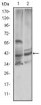Cystatin C antibody, abx011640, Abbexa, Enzyme Linked Immunosorbent Assay image 