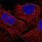 G Protein-Coupled Receptor Kinase 2 antibody, NBP2-57283, Novus Biologicals, Immunofluorescence image 