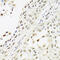 RNA Transcription, Translation And Transport Factor antibody, 19-068, ProSci, Immunohistochemistry frozen image 