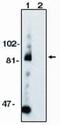 ADAM Metallopeptidase Domain 10 antibody, PA1-12500, Invitrogen Antibodies, Western Blot image 