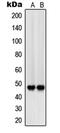 Signal Regulatory Protein Beta 1 antibody, MBS821679, MyBioSource, Western Blot image 