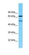 Transmembrane Protein 232 antibody, orb327130, Biorbyt, Western Blot image 