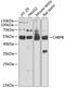 Complement Component 4 Binding Protein Beta antibody, GTX33051, GeneTex, Western Blot image 
