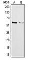 Cytochrome P450 Family 3 Subfamily A Member 4 antibody, MBS821900, MyBioSource, Western Blot image 