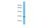 T Cell-Interacting, Activating Receptor On Myeloid Cells 1 antibody, A17726, Boster Biological Technology, Western Blot image 