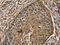 Zinc Finger MIZ-Type Containing 1 antibody, CSB-PA103365, Cusabio, Immunohistochemistry paraffin image 