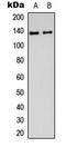 DEAH-Box Helicase 8 antibody, LS-C355995, Lifespan Biosciences, Western Blot image 