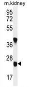 Unc-119 Lipid Binding Chaperone B antibody, AP54431PU-N, Origene, Western Blot image 