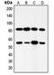 Phosphoinositide-3-Kinase Regulatory Subunit 1 antibody, MBS821649, MyBioSource, Western Blot image 