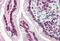 Karyopherin Subunit Alpha 4 antibody, GTX26039, GeneTex, Immunohistochemistry paraffin image 