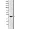 Signal Sequence Receptor Subunit 1 antibody, abx218772, Abbexa, Western Blot image 