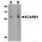 Scavenger Receptor Class B Member 1 antibody, LS-C108452, Lifespan Biosciences, Western Blot image 