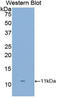 S100 Calcium Binding Protein A8 antibody, LS-C303282, Lifespan Biosciences, Western Blot image 