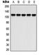 ATPase Na+/K+ Transporting Subunit Alpha 2 antibody, orb315756, Biorbyt, Western Blot image 