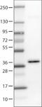 Growth Differentiation Factor 15 antibody, NBP2-52917, Novus Biologicals, Western Blot image 