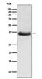 NFKB Inhibitor Alpha antibody, M01139, Boster Biological Technology, Western Blot image 