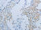 Junction Plakoglobin antibody, CSB-PA044408, Cusabio, Immunohistochemistry paraffin image 