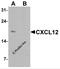 C-X-C Motif Chemokine Ligand 12 antibody, 7591, ProSci, Western Blot image 