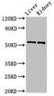 Matrix Metallopeptidase 3 antibody, LS-C285779, Lifespan Biosciences, Western Blot image 