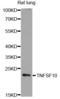 TNF Superfamily Member 10 antibody, LS-C747215, Lifespan Biosciences, Western Blot image 