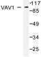 Vav Guanine Nucleotide Exchange Factor 1 antibody, LS-C176251, Lifespan Biosciences, Western Blot image 