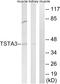 Tissue Specific Transplantation Antigen P35B antibody, A30702, Boster Biological Technology, Western Blot image 