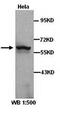 mRNA-decapping enzyme 1A antibody, orb77324, Biorbyt, Western Blot image 