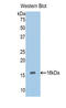 ADAM Metallopeptidase With Thrombospondin Type 1 Motif 1 antibody, LS-C292572, Lifespan Biosciences, Western Blot image 