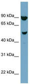 Iroquois Homeobox 2 antibody, TA342486, Origene, Western Blot image 