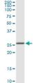 Replication Protein A4 antibody, H00029935-D01P, Novus Biologicals, Western Blot image 