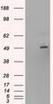 One Cut Homeobox 1 antibody, M07349, Boster Biological Technology, Western Blot image 