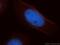 Calponin 3 antibody, 11509-1-AP, Proteintech Group, Immunofluorescence image 