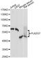 Phospholipase A2 Group VII antibody, A13864, ABclonal Technology, Western Blot image 