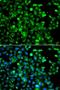 Calpain-5 antibody, LS-C349131, Lifespan Biosciences, Immunofluorescence image 