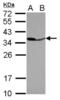 Pyrophosphatase (Inorganic) 1 antibody, NBP2-20021, Novus Biologicals, Western Blot image 