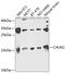 Calmodulin antibody, A31737, Boster Biological Technology, Western Blot image 