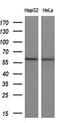ETS Proto-Oncogene 2, Transcription Factor antibody, M02641, Boster Biological Technology, Western Blot image 