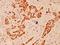 Eukaryotic Translation Elongation Factor 2 antibody, A00830, Boster Biological Technology, Immunohistochemistry paraffin image 