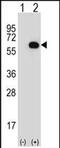 Glycerol Kinase antibody, PA5-71764, Invitrogen Antibodies, Western Blot image 