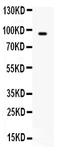 Breast cancer anti-estrogen resistance protein 3 antibody, PB9846, Boster Biological Technology, Western Blot image 