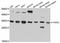 Translin Associated Factor X antibody, STJ114165, St John