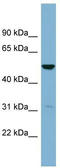 Serine Dehydratase Like antibody, TA337916, Origene, Western Blot image 