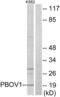 Prostate And Breast Cancer Overexpressed 1 antibody, LS-C119252, Lifespan Biosciences, Western Blot image 