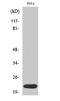 Dynein Axonemal Light Chain 1 antibody, STJ92796, St John