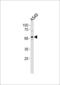 Zinc Finger With KRAB And SCAN Domains 4 antibody, LS-C157410, Lifespan Biosciences, Western Blot image 