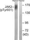 Janus Kinase 2 antibody, PA5-39740, Invitrogen Antibodies, Western Blot image 